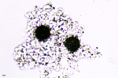 scleroderma-citrinum8