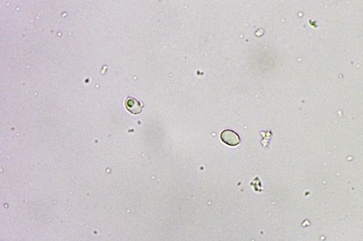 sparassis-brevipes9