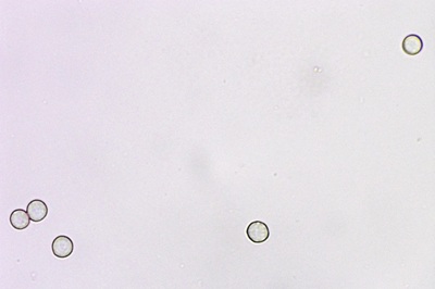 stemonitis-axifera5
