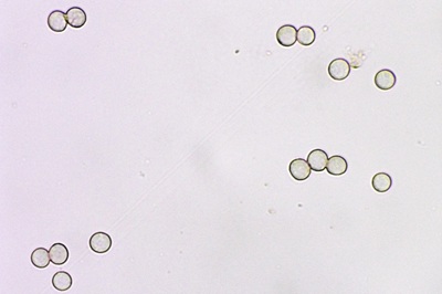 stemonitis-axifera6
