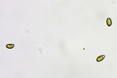 stropharia-aeruginosa5