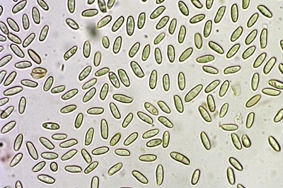 suillus-grevillei11
