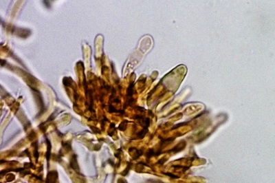 tectella-patellaris11