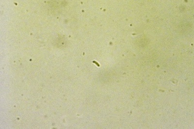 tectella-patellaris6