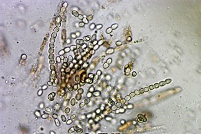 trichoderma-pulvinatum10