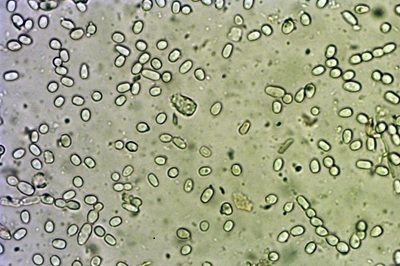 trichoderma-pulvinatum9