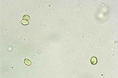 tricholoma-pardinum11