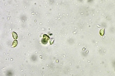 tricholoma-squarrulosum11