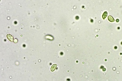 tricholoma-squarrulosum5