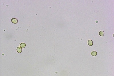 tricholomopsis-rutilans9