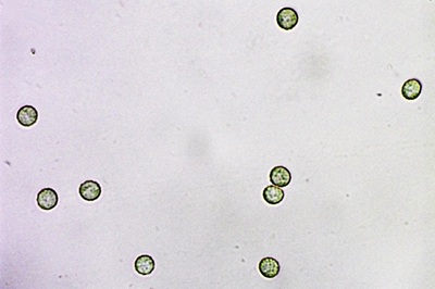 tubifera-ferruginosa10