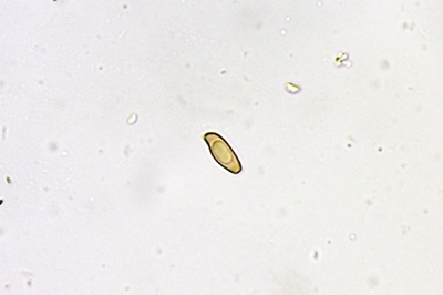 xerocomellus-porosporus4