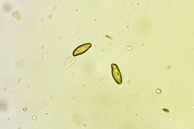 xerocomellus-porosporus5