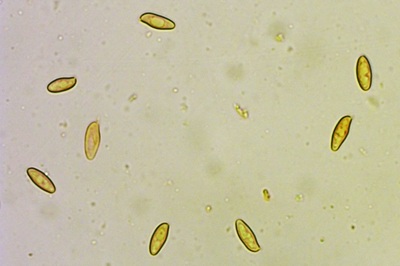 xerocomus-subtomentosus10