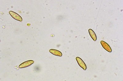 xerocomus-subtomentosus9