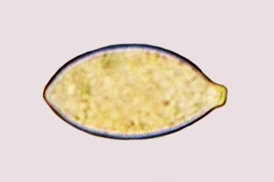 Botryobasidium aureum