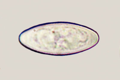Byssonectria terrestris