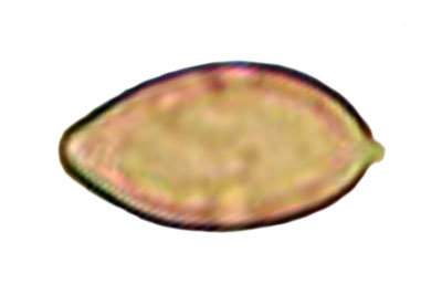 Inocybe griseolilacina