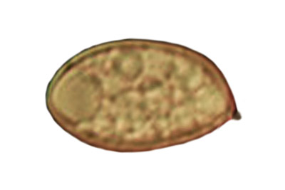 Inocybe vulpinella