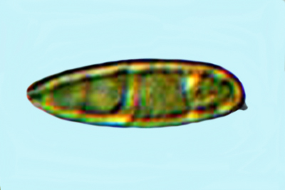 Leccinellum corsicum