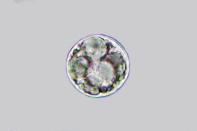 Pulvinula convexella