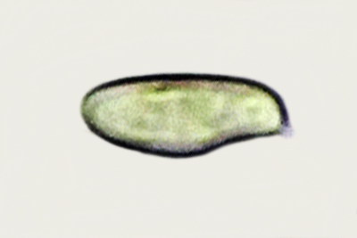 Rheubarbariboletus armeniacus