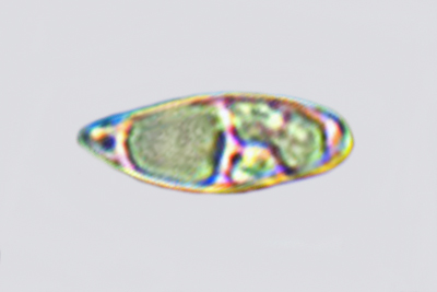 Rubroboletus dupainii