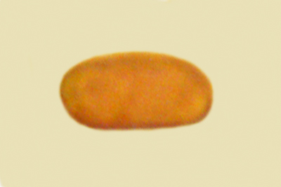 Sarcoporia polyspora