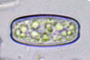 Sarcoscypha austriaca