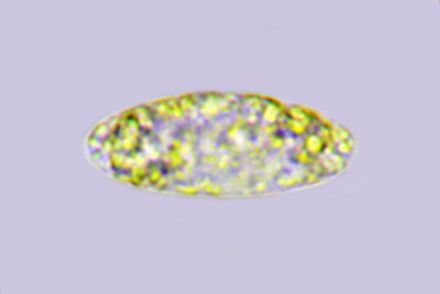 Sarcoscypha coccinea