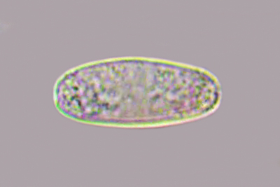 Sarcoscypha macaronesica