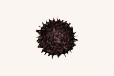 Scleroderma areolatum