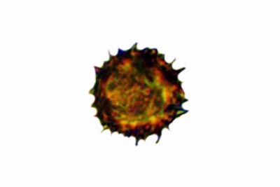 Scleroderma verrucosum