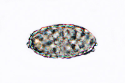 Scutellinia scutellata