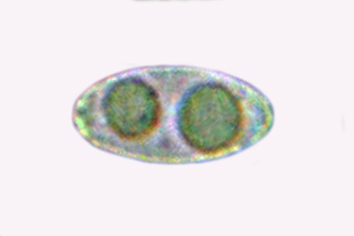 Sowerbyella imperialis