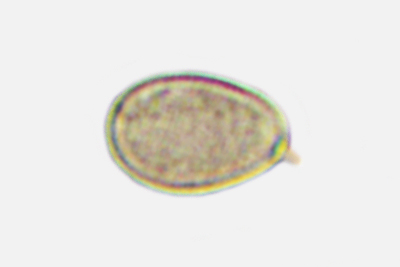 Sphaerobolus stellatus