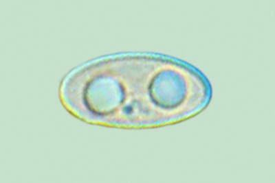 Trichophaea abundans