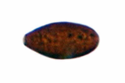 Tulosesus bisporiger