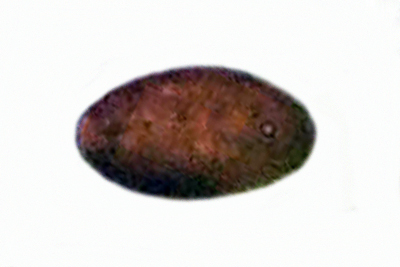 Tulosesus brevisetulosus