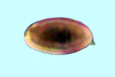 Tulosesus congregatus