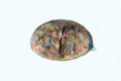 Tulosesus heterosetulosus