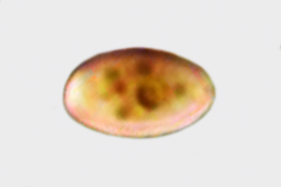 Tulosesus plagioporus