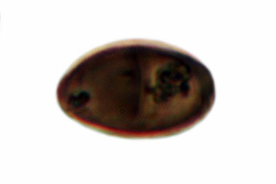 Tulosesus subdisseminatus