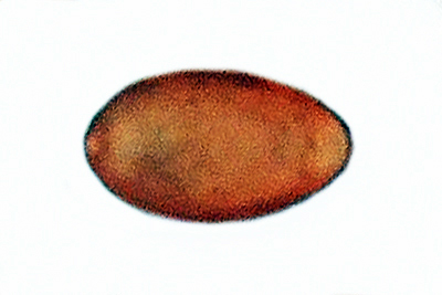 Tulosesus subpurpureus