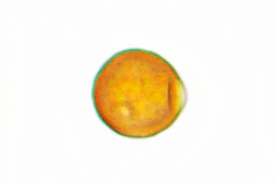 Uromyces pisi-sativi