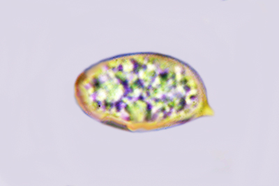 Volvopluteus gloiocephalus